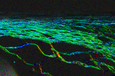 A network of glowing green strands against a black backround. The strands, which are scar tissue, are wavy but roughly parallel to each other.