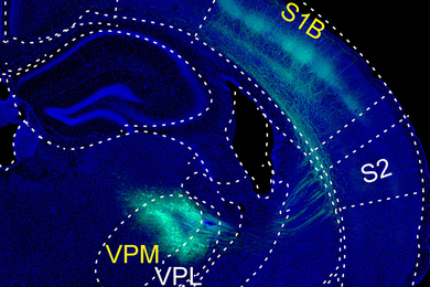 Microscopic image of tissue from the somatosensory cortex, partitioned with dotted lines and text labels, with pain-related neurons highlighted in green.
