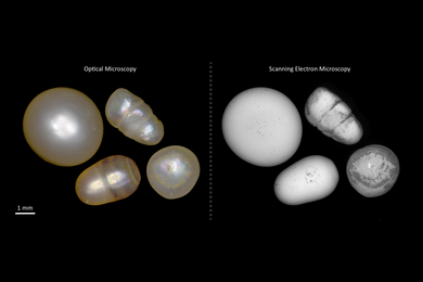 Rounded white shapes on a black background show the appearance of pearls under optical and scanning electron microscopy
