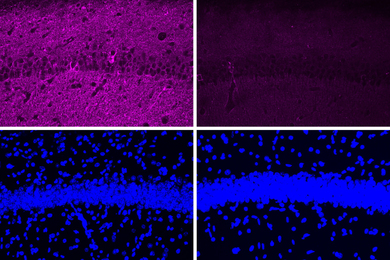 4 panels, with two stained purple on top and two stained blue on bottom. In the top two, there is a significant decrease in the purple color, which represents Tau proteins, and the top right is darker and much less purple. The bottom two panels are very similar, and show nuclei as bright blue bits, like pebbles. A thick band of the blue bits across the center of the panels.