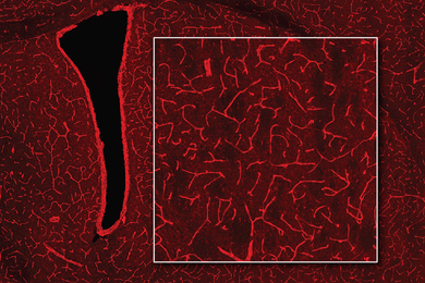 A MRI image of a brain shows bright red blood vessels on a darker red background.