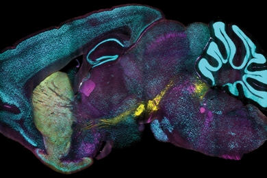 Detailed anatomical cross section highlights patches of thousands of neurons lit up in cyan, magenta, or yellow.