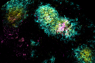 Microscope view of colorful splotches.