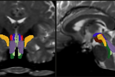 In two panels there are face-on and side-view cross sections of a human brain in pixellated gray. In the bottom center of each image color-coded crescent shapes delineate discrete nerve fiber bundles.